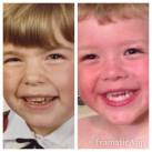 Blake Mommy at age 4-5